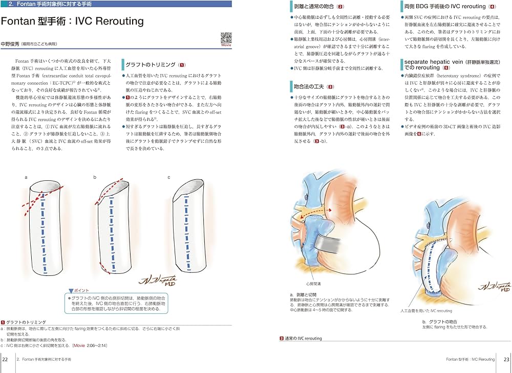 先天性心疾患の手術 | 坂本喜三郎, 長田信洋 |本 | 通販 | Amazon