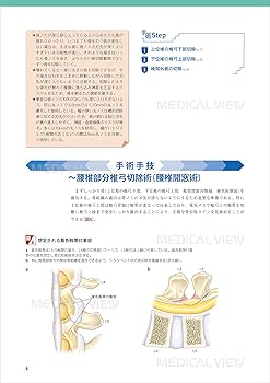 ベーシックな脊椎除圧術のすべて (新OS NEXUS No.3) | 今釜 史郎 |本