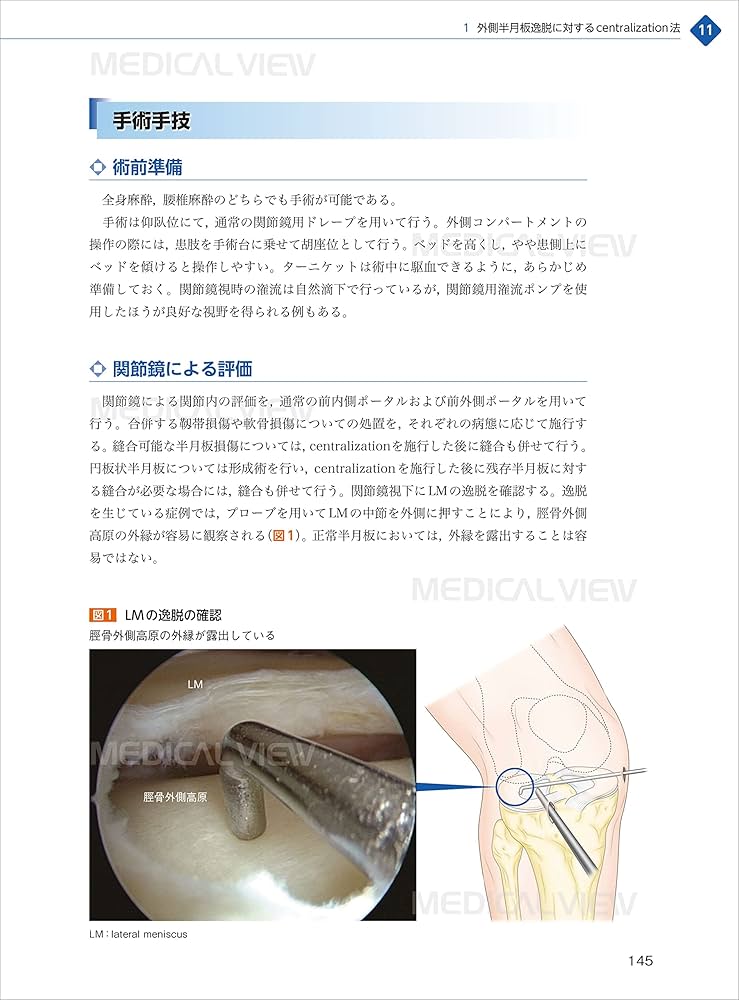 81dvCH6EkDL._AC_UF1000,