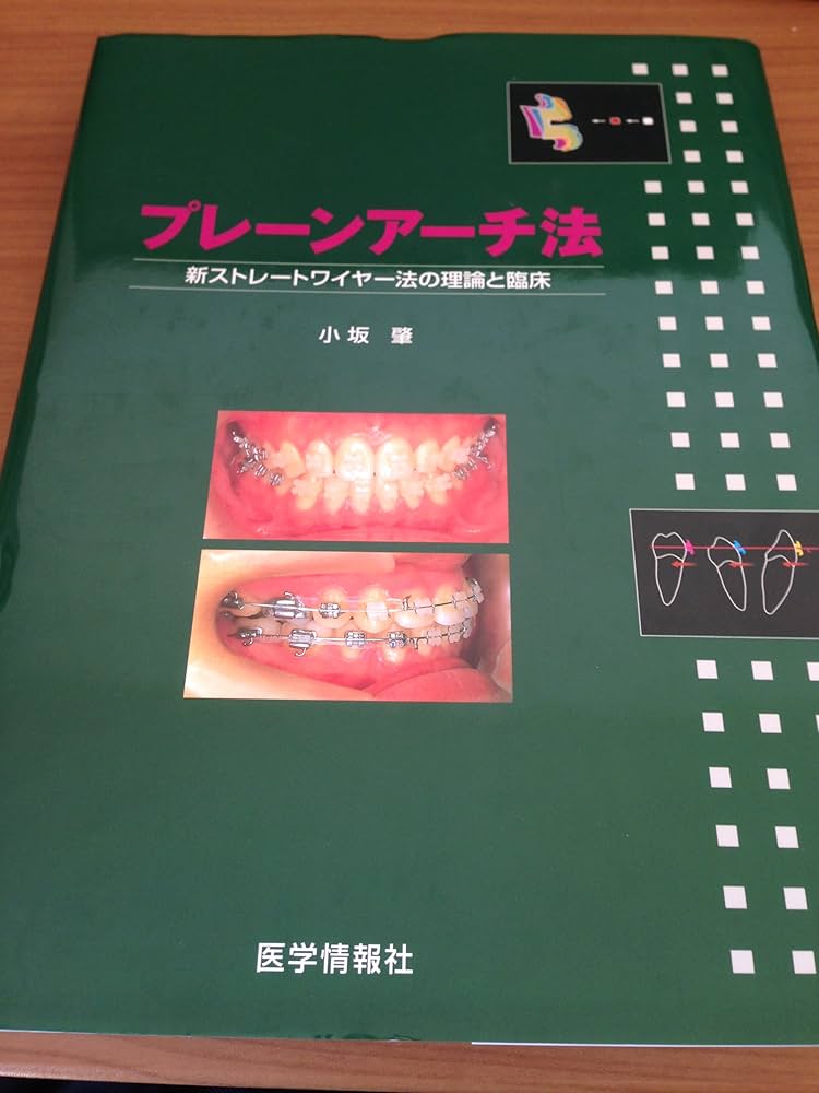 Amazon.co.jp: プレーンアーチ法 : Japanese Books