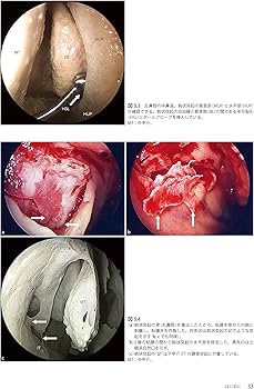 Amazon.co.jp: ウォーモルド内視鏡下鼻副鼻腔・頭蓋底手術 : 本間 明宏: 本
