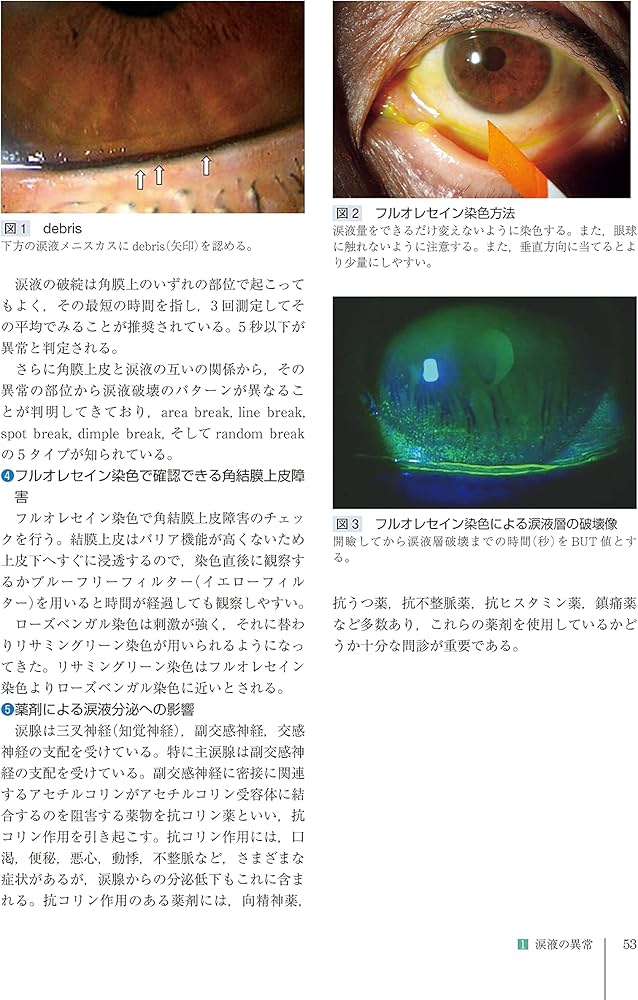 Amazon.co.jp: 角膜クリニック 第3版 : 眞鍋 禮三, 木下 茂, 大橋 裕一