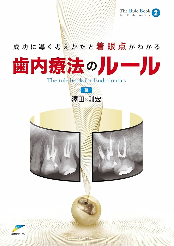 Amazon.co.jp: 成功に導く考えかたと着眼点がわかる歯内療法のルール