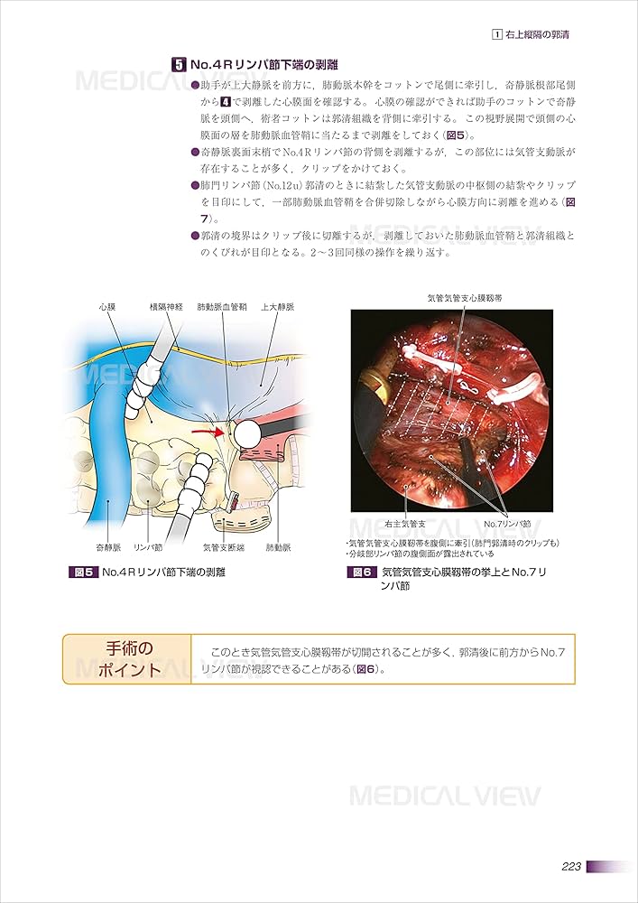 肺癌 (がん研スタイル 癌の標準手術) | 奥村 栄, 文 敏景(編集協力