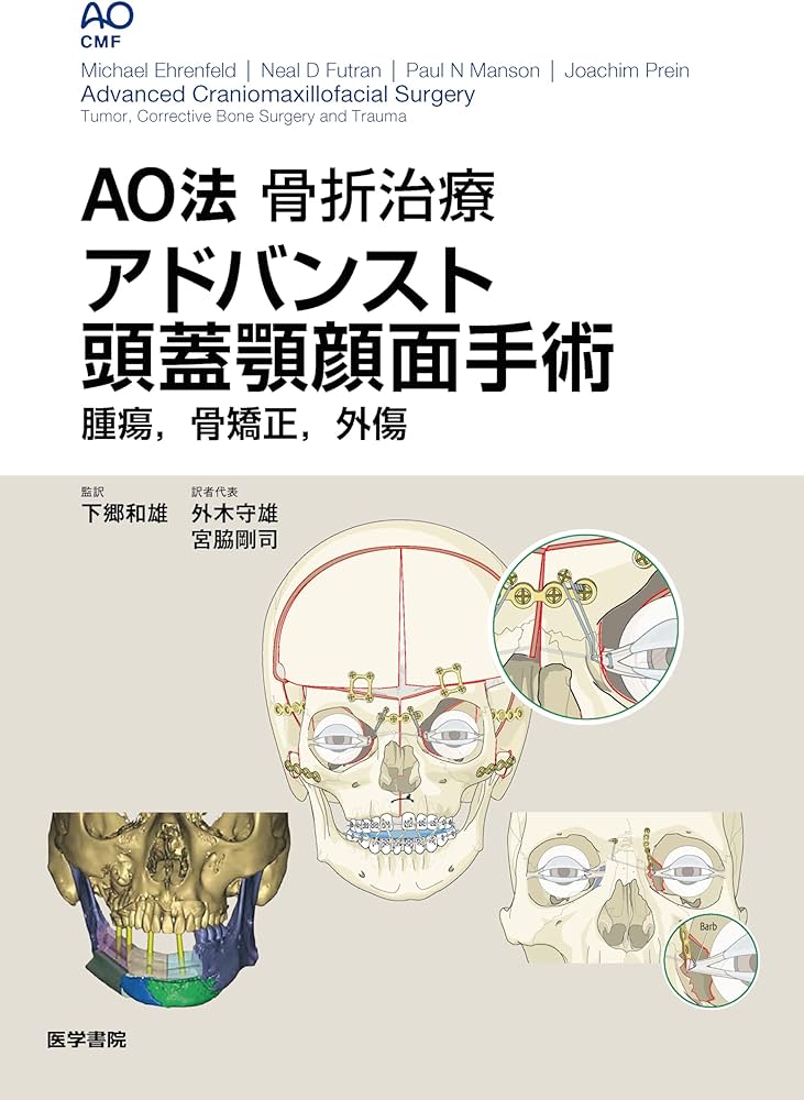 AO法骨折治療 アドバンスト頭蓋顎顔面手術: 腫瘍、骨矯正、外傷 | 下郷