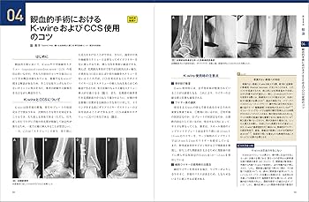 81l5BZomxgL._AC_UF350,