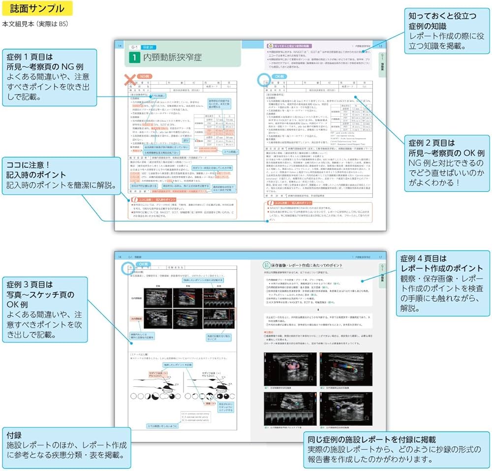 超音波検査士認定試験対策にも使える! これでOK! 血管エコー報告書の