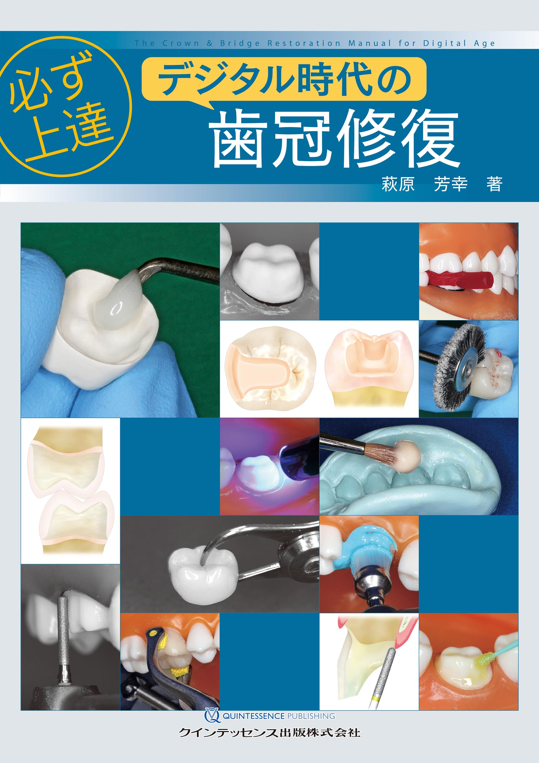 必ず上達 デジタル時代の歯冠修復 | 萩原芳幸 |本 | 通販 | Amazon