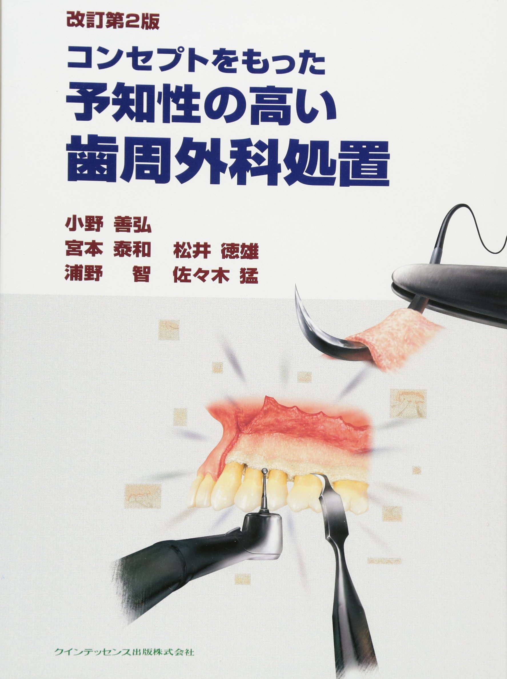 コンセプトをもった予知性の高い歯周外科処置 改訂第2版 | 小野 善弘