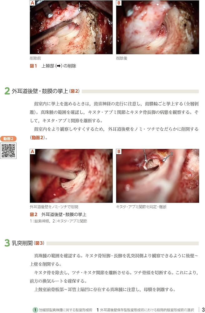 エキスパートによる 短期入院のための耳鼻咽喉科手術手技 -動画144本を