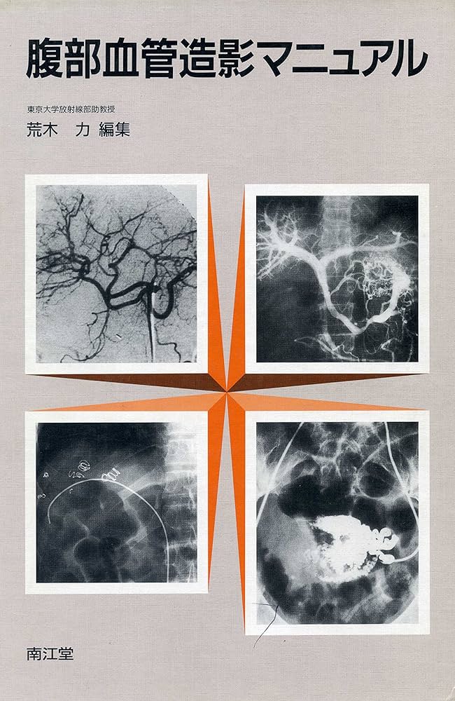 Amazon.co.jp: 腹部血管造影マニュアル : 荒木 力: 本