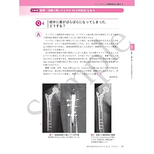 インプラント周囲骨折を極める | 馬場智規 |本 | 通販 | Amazon