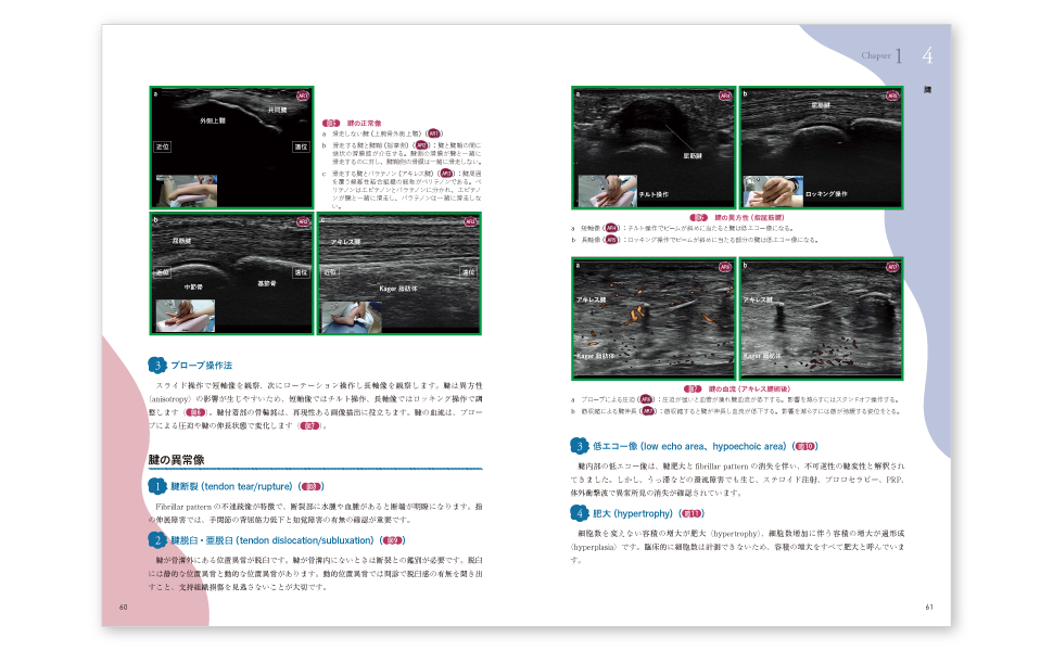 運動器エコーのメタ診療: 実臨床に役立つAR動画100本付き | 皆川 洋至