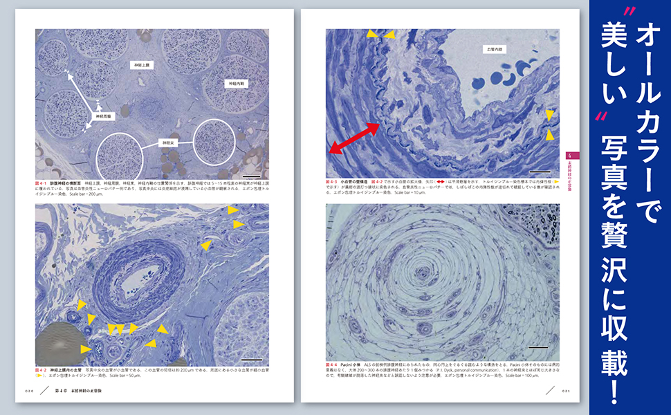 末梢神経病理：どう作り、どう読み、どう臨床に生かすか | 神田隆