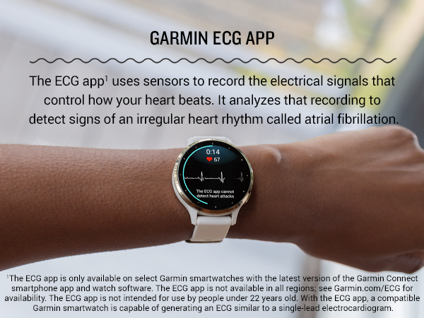 Amazon.com: Garmin Venu 3S Soft Gold Stainless Steel Bezel 1.2