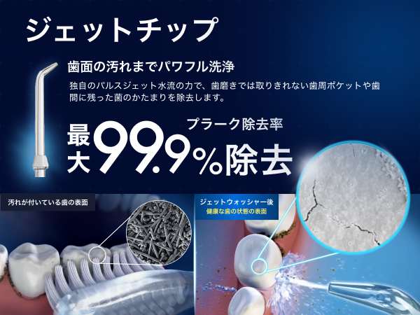 Amazon | waterpik ウォーターピック【正規品】世界シェアNo,1 世界の