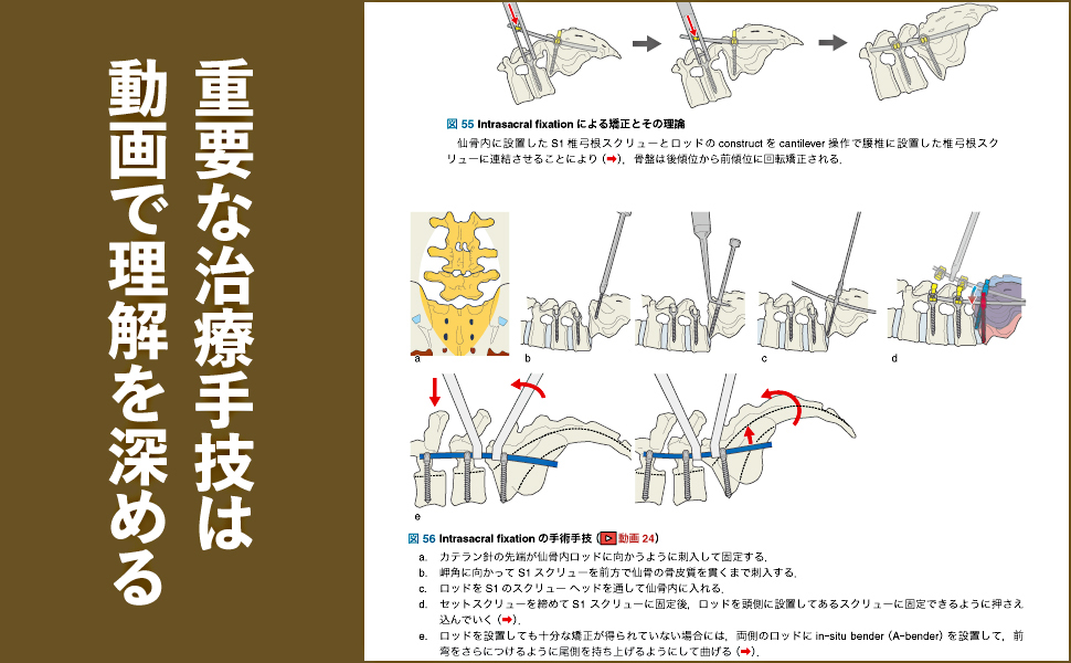 Amazon.co.jp: 症例から学ぶ小児脊柱変形（基礎から難治性疾患まで