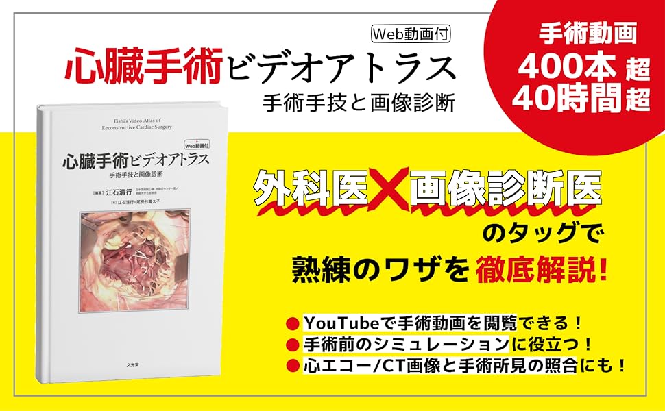 心臓手術ビデオアトラス 手術手技と画像診断［Web動画付］ | 江石清行