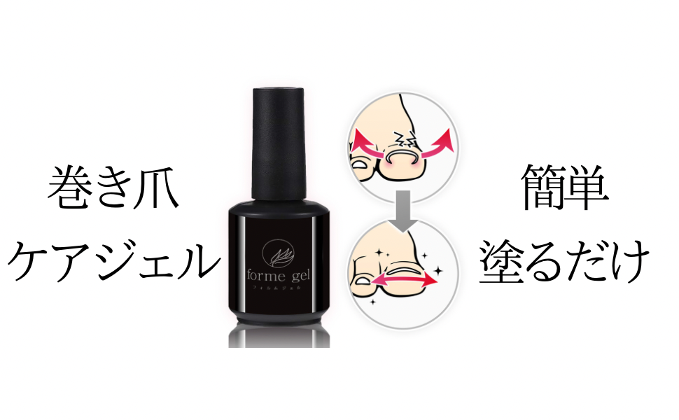 Amazon | フォルムジェル 誰でも簡単！塗るだけ！巻き爪ケアジェル