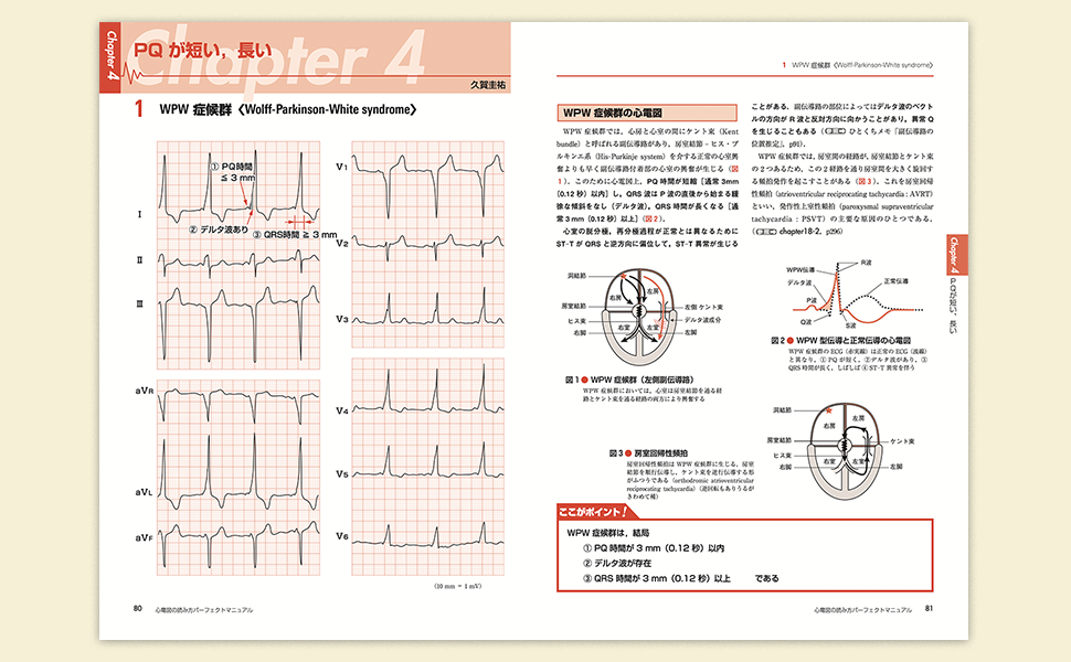 心電図の読み方パーフェクトマニュアル―理論と波形パターンで徹底