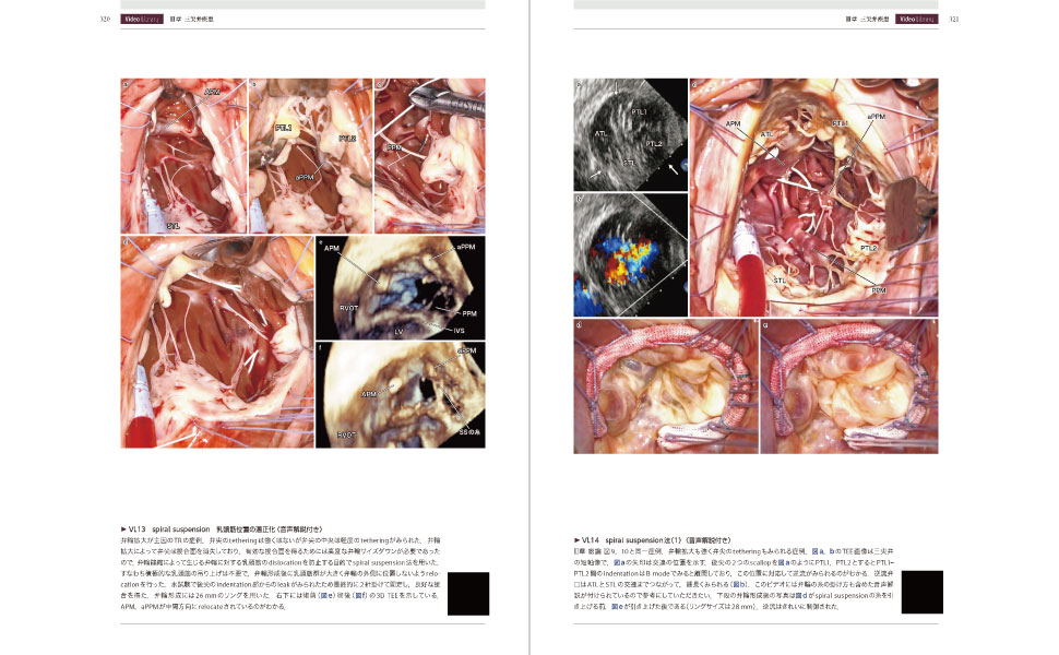 心臓手術ビデオアトラス 手術手技と画像診断［Web動画付］ | 江石清行