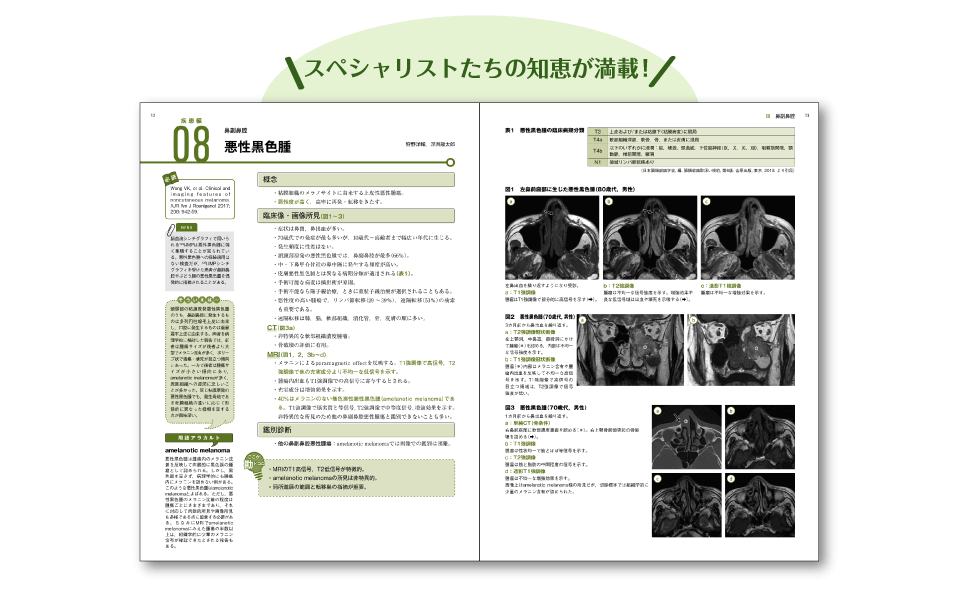 頭部 画像診断の勘ドコロNEO | 田岡 俊昭 |本 | 通販 | Amazon