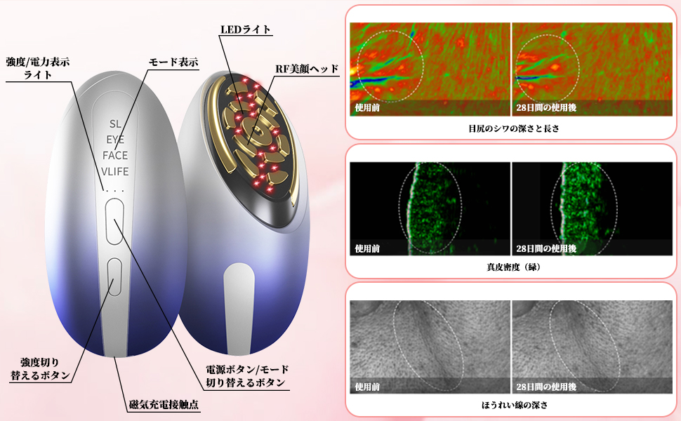 Amazon.co.jp: Redfire 美顔器【2024年業界最新スタンプ式RF美顔器