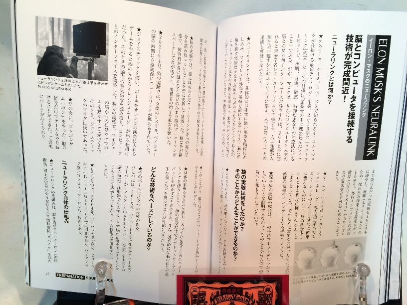 トレパネーションソースブック[増補バイリンガル版] 頭蓋骨穴開け手術