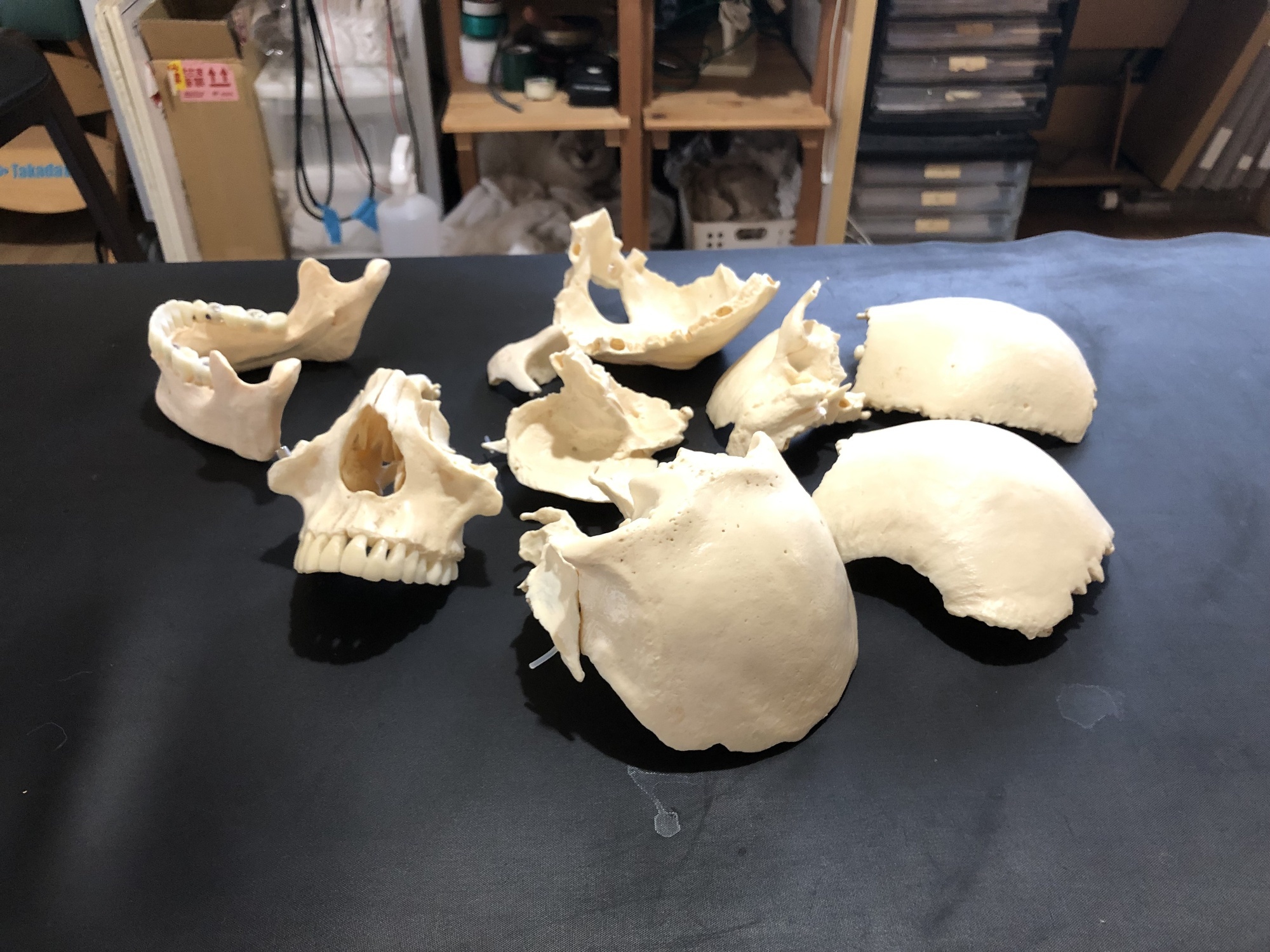 SOT｜広島県尾道市で腰痛、肩こりの改善、自律神経の調整を得意とする