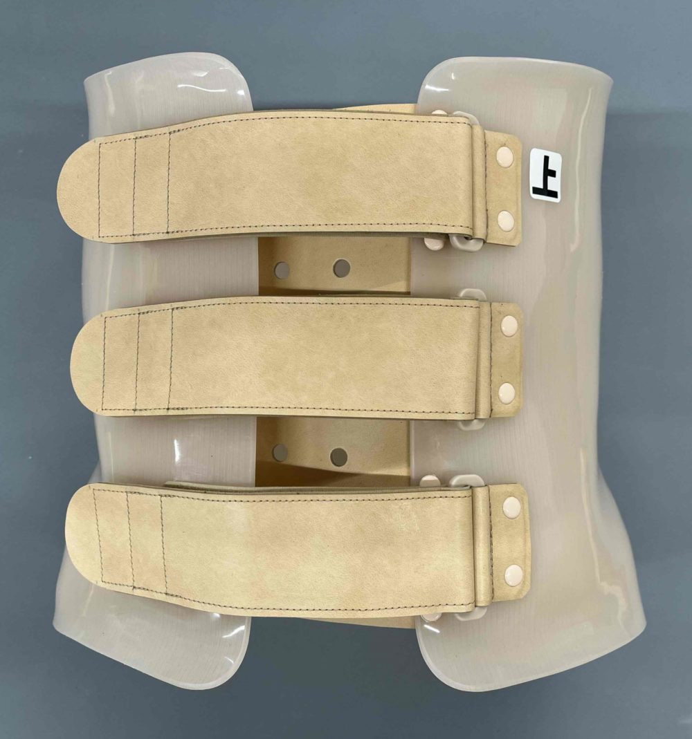 体幹装具（硬性） | 神奈川県藤沢市にある義肢補装具製作の株式会社エニー