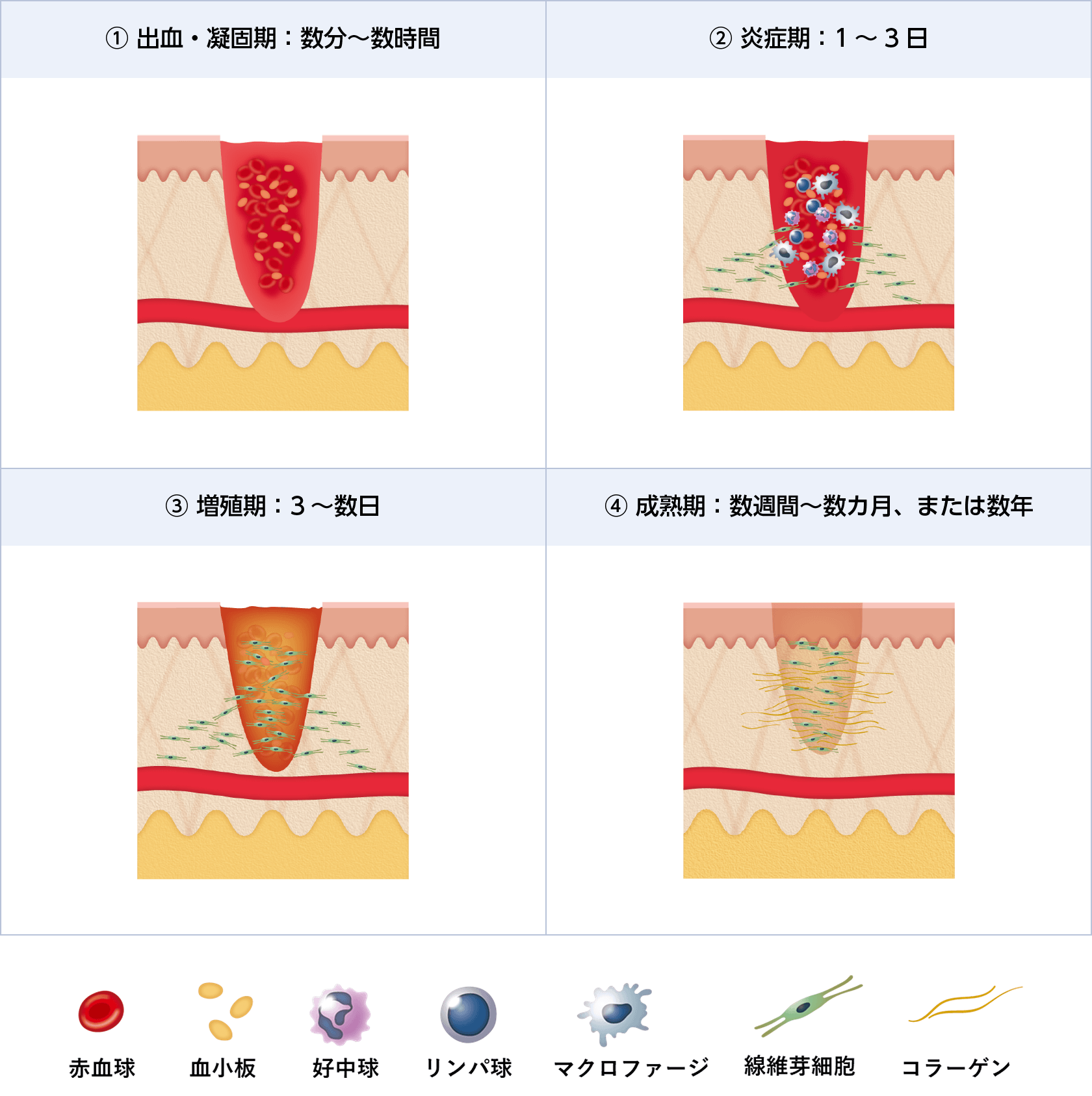 Essentials-創傷治療-:総論 | Essentials-創傷治療- | 科研製薬 医療