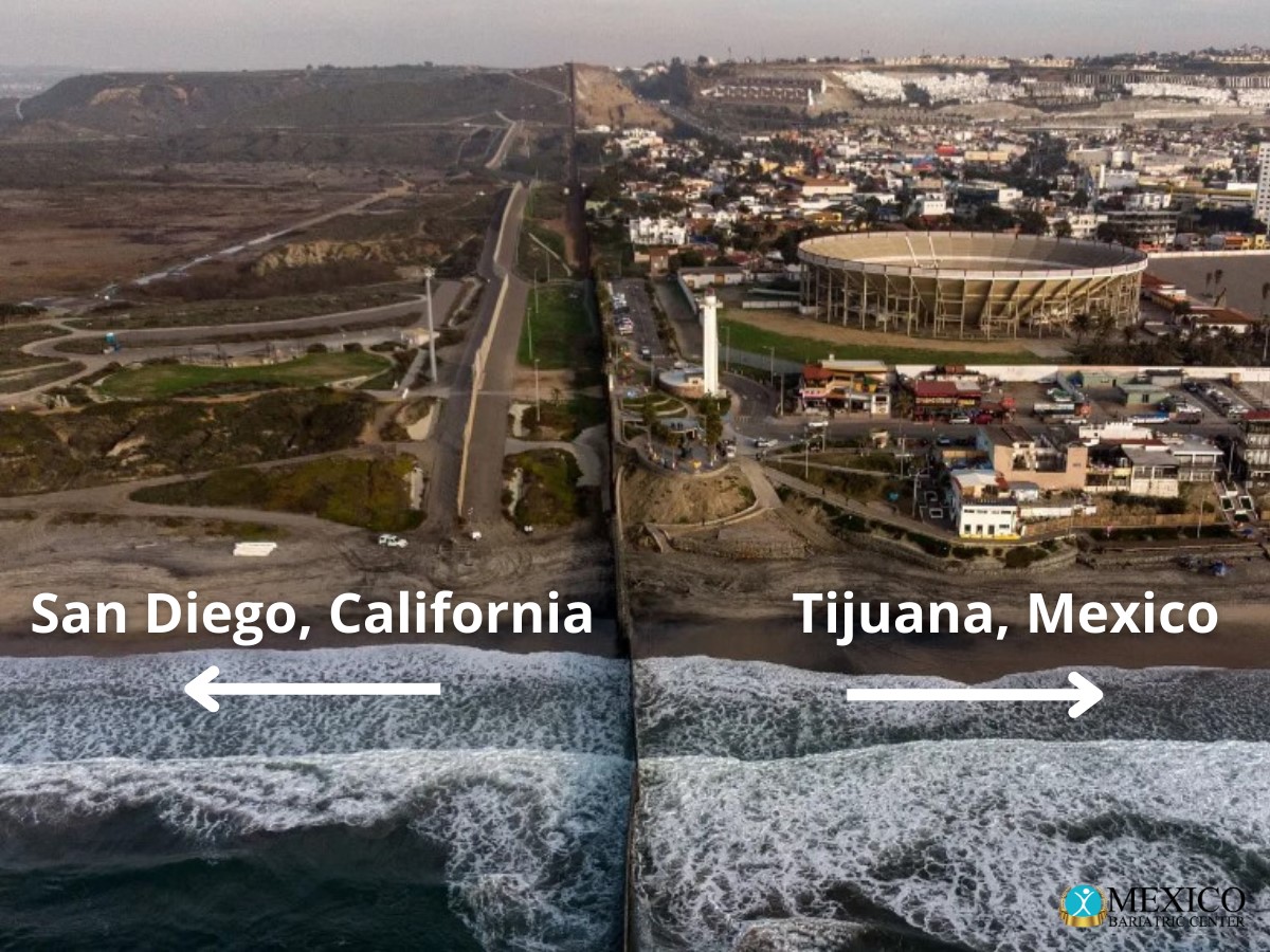 2025 Guide: How to Travel to Mexico Safely for Surgery