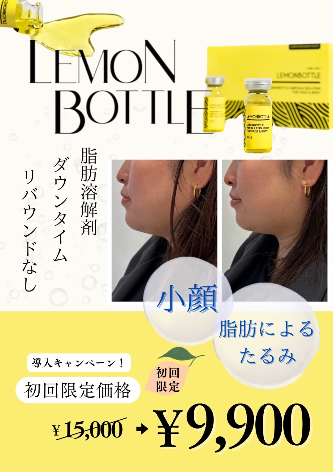 脂肪溶解☆レモンボトルで小顔に♪ | ららぽーと甲子園