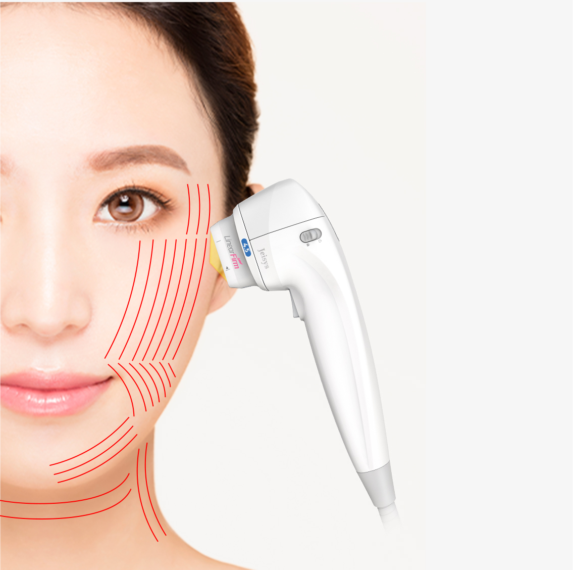 HIFUリニアファーム（脂肪溶解ハイフ） - みやびスキンクリニック