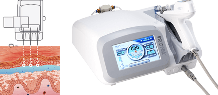 水光注射（幹細胞上清液） | 美容外科、婦人科形成の東京のモティーフ