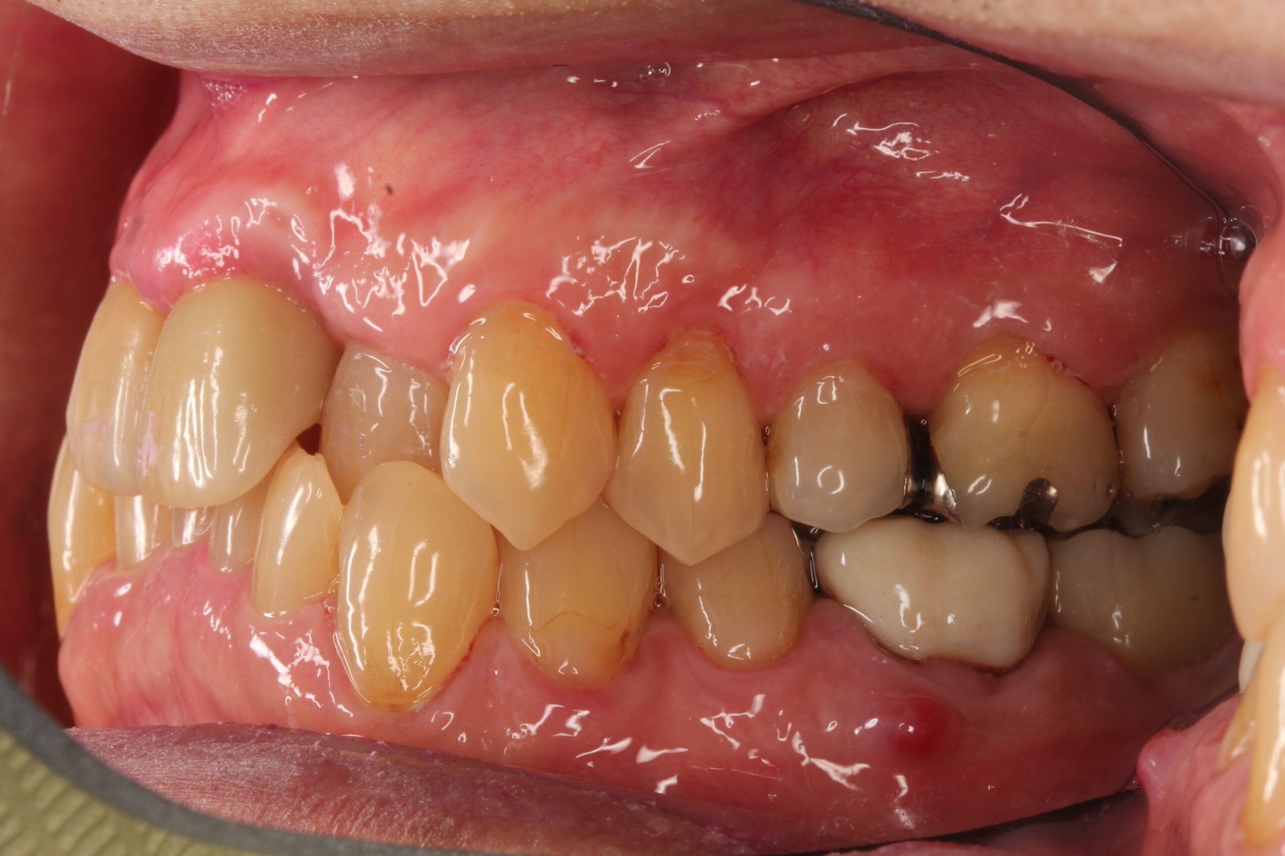 裁断済み】オープンバリアメンブレンテクニック 有限会社 医学情報社
