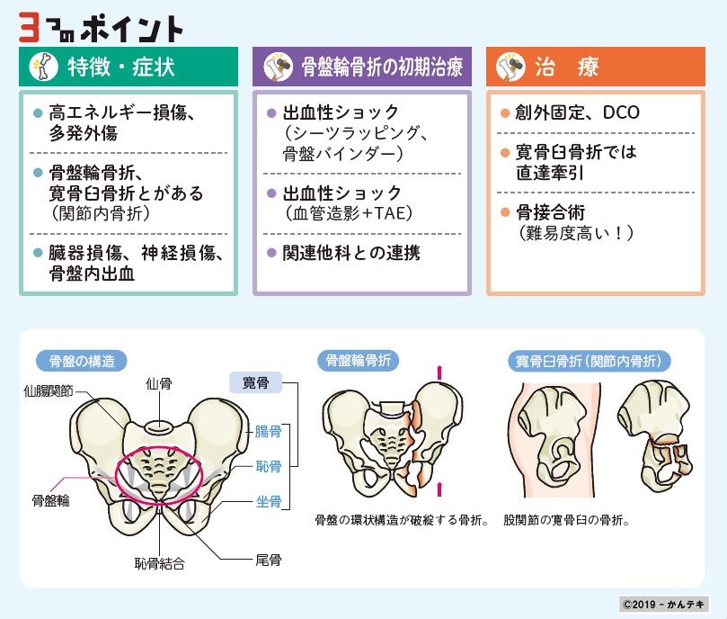 1分間でコレだけは覚えるコレだけシート… #028｜骨盤骨折 | かんテキ