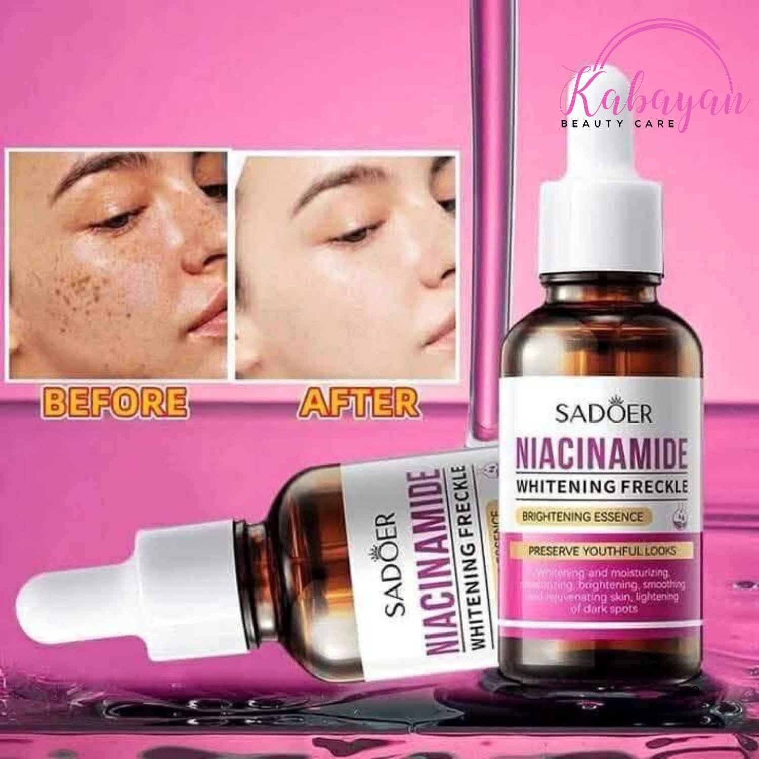 Sadoer Niacinamide Whiten Anti-Freckle 30ml – My Care Kits