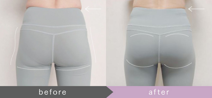 MYTREX AQUA LIFT | EMS ヒップトレーニングマシーン | お風呂で作る