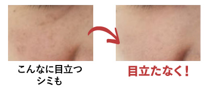 ルソイル コンシーラーファンデーション | ［薬用美白］ルソイル