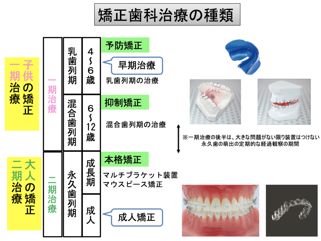 矯正歯科治療の種類｜奈良の矯正歯科なら【おとなとこどもの歯並び