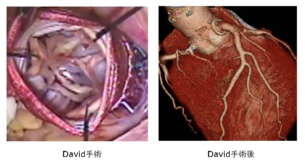 名古屋ハートセンター＜循環器医療のスペシャリストとして＞ | 弁膜症手術