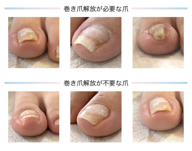 □RESISTANCE PLATE(レジスタンスプレート)商品一覧 / NESオンライン