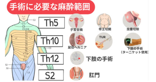 脊椎くも膜下麻酔 基本知識