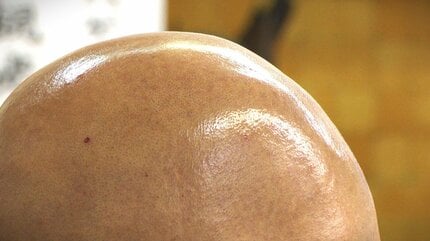 吸盤に愛されようと思って…」“ハゲの祭典” 絶対に負けられない『ハゲ