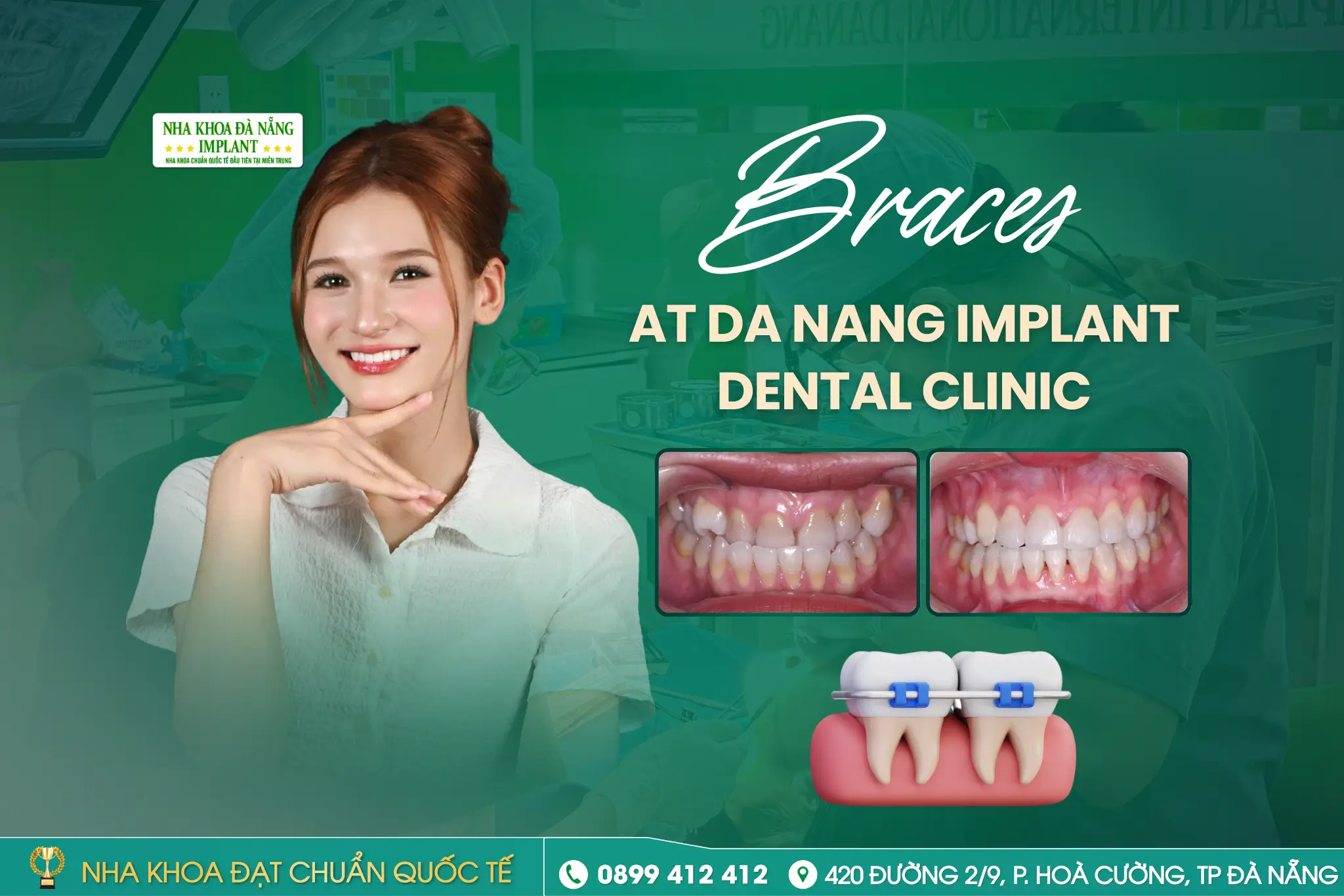 How Is Adult Orthodontic Treatment Different from Teen