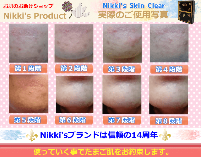 ニッキーズスキンクリア Nikki's Skin Clear 通常使用 (シミ、そばかす