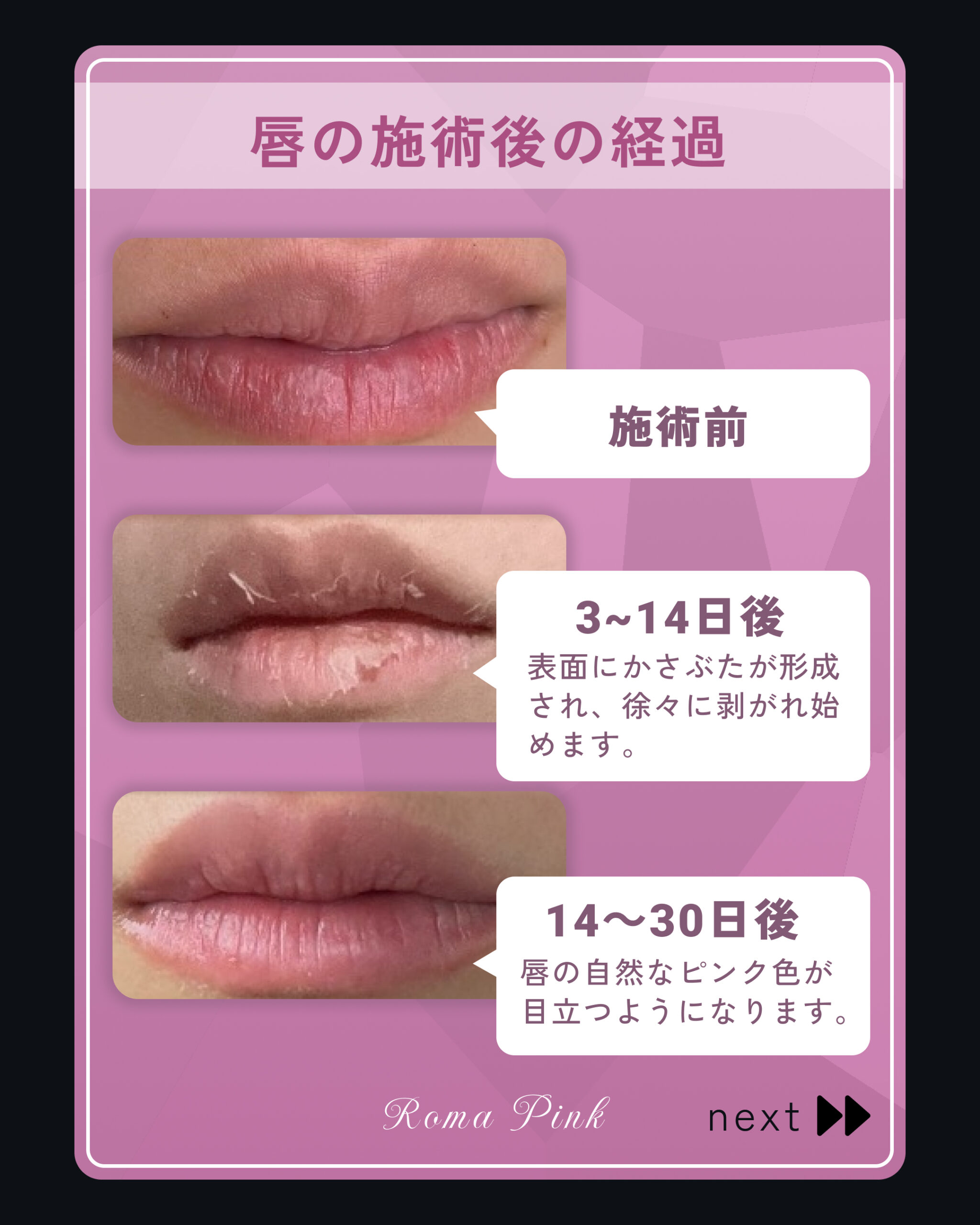 ローマピンクの取り扱いを開始します。 | 二子玉川駅3分：二子玉川