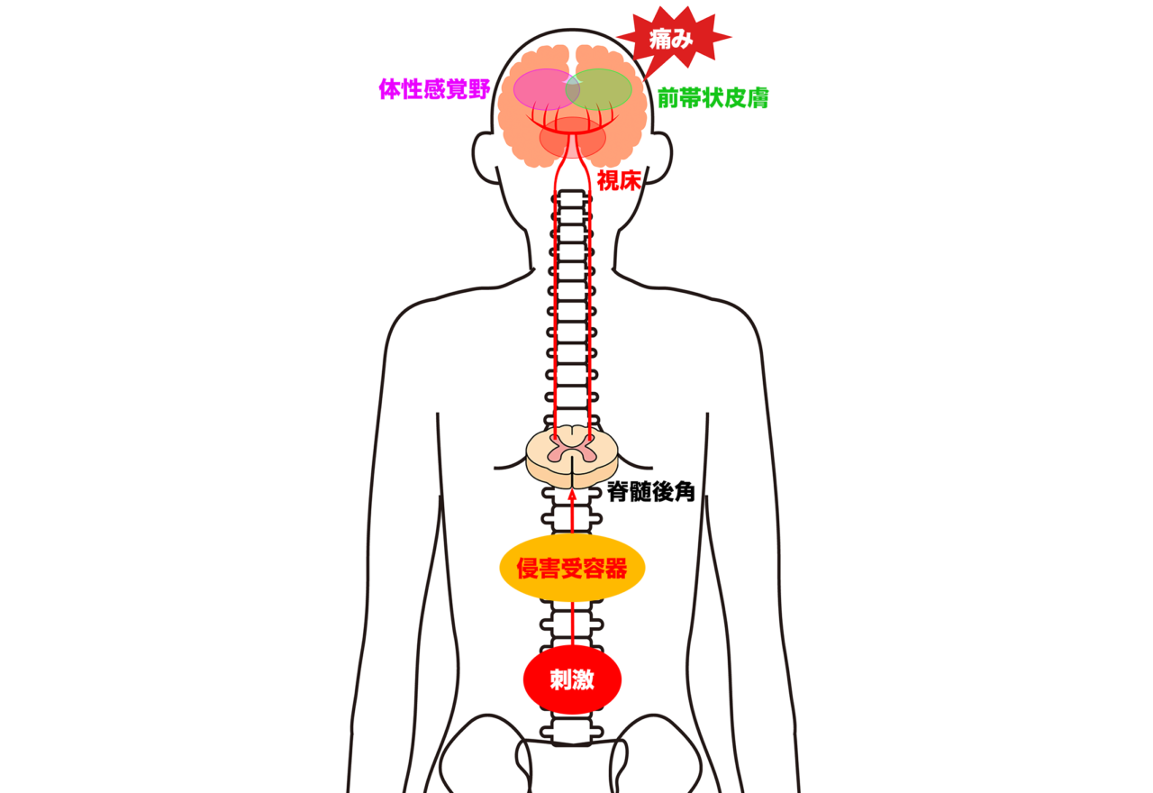 第1回】知れば得する痛みの構造と分類：知っておくべき痛みの仕組み
