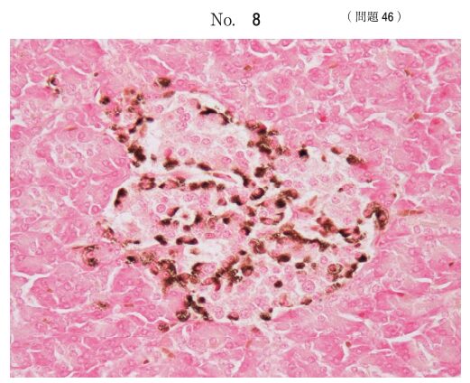 第71回臨床検査技師国家試験【午後】 解説・裏回答・周辺知識まとめ